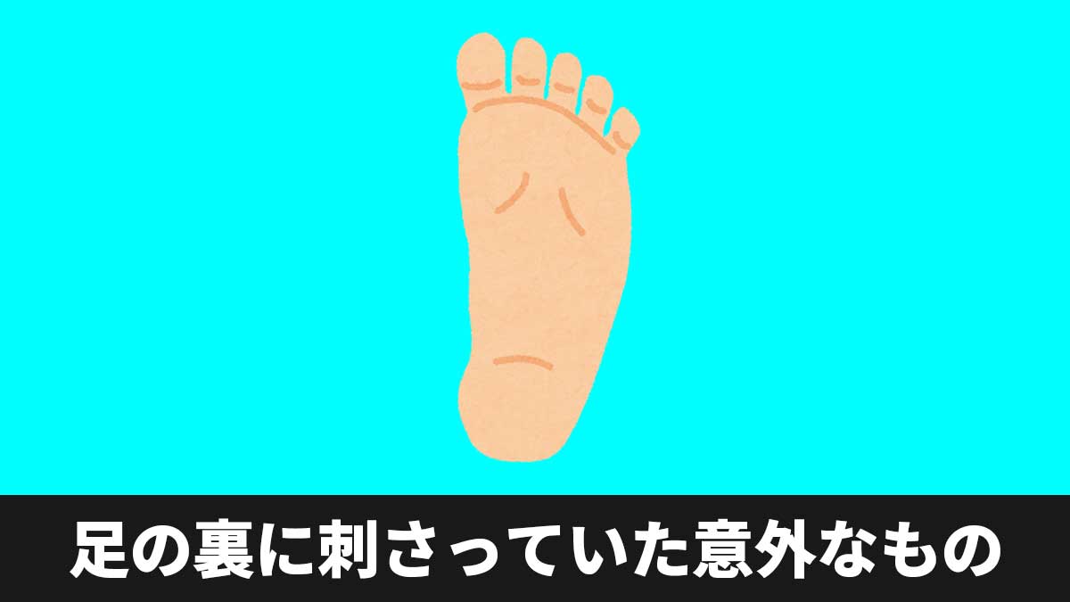 足の裏に刺さっていた意外なもの
